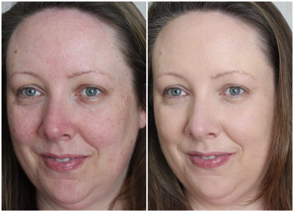 before&after